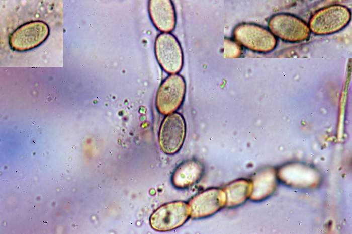 macrostoma