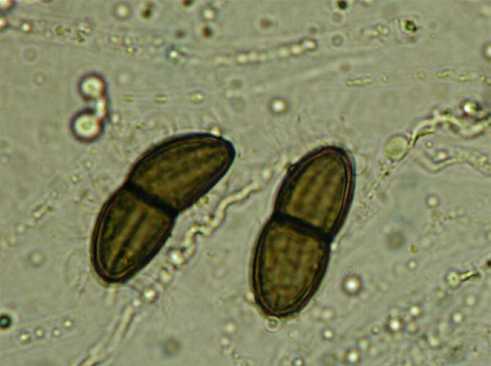 macrostoma