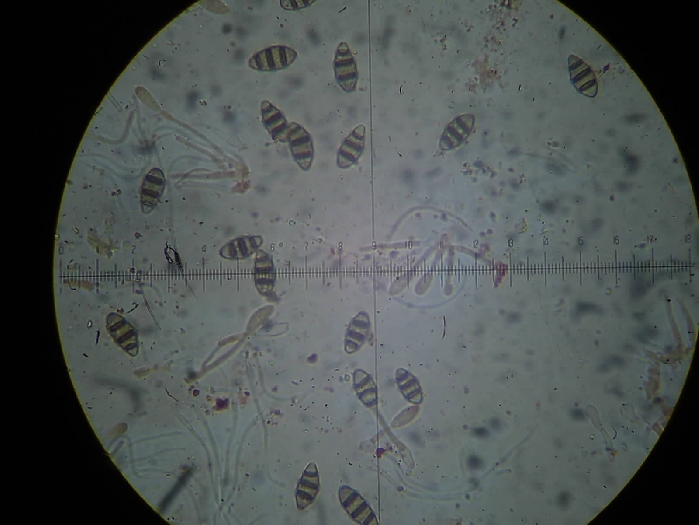 macrostoma