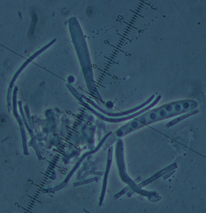 macrostoma