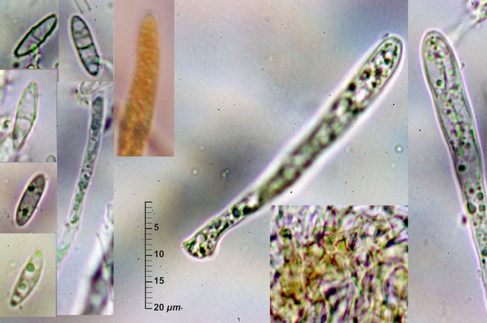 macrostoma