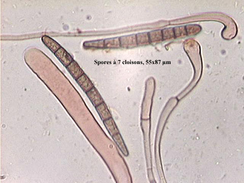 macrostoma