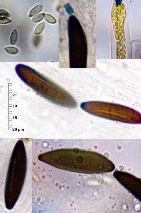 macrostoma