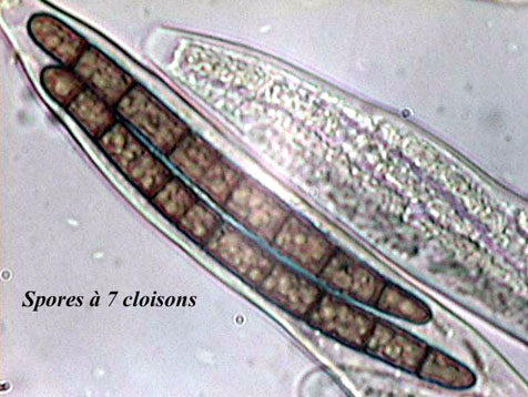 macrostoma