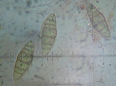 macrostoma