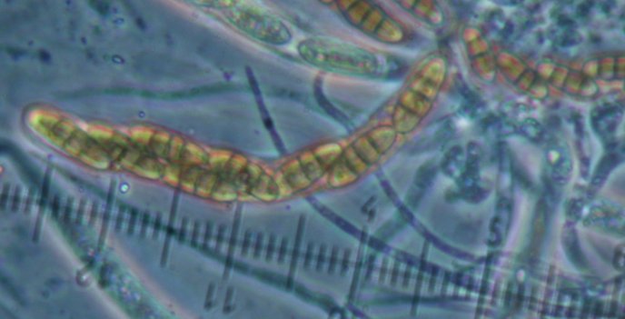 macrostoma