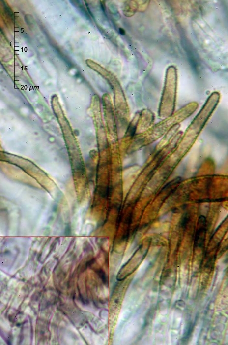 macrostoma