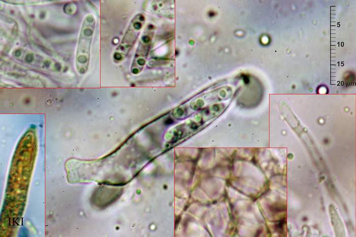 macrostoma
