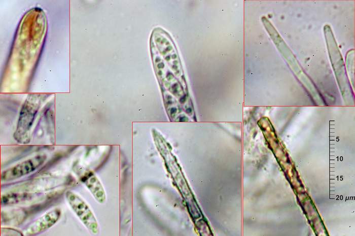 macrostoma