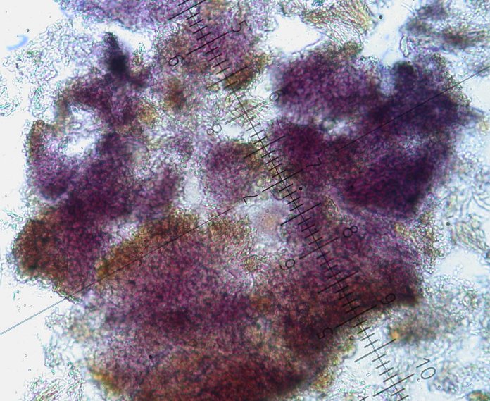 macrostoma