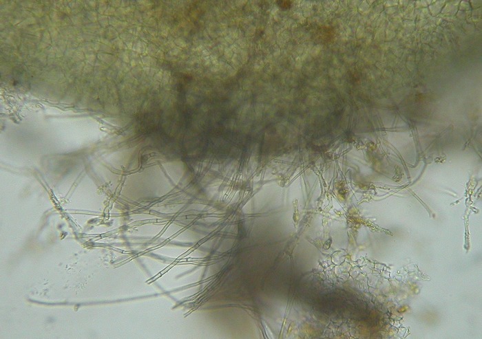 macrostoma