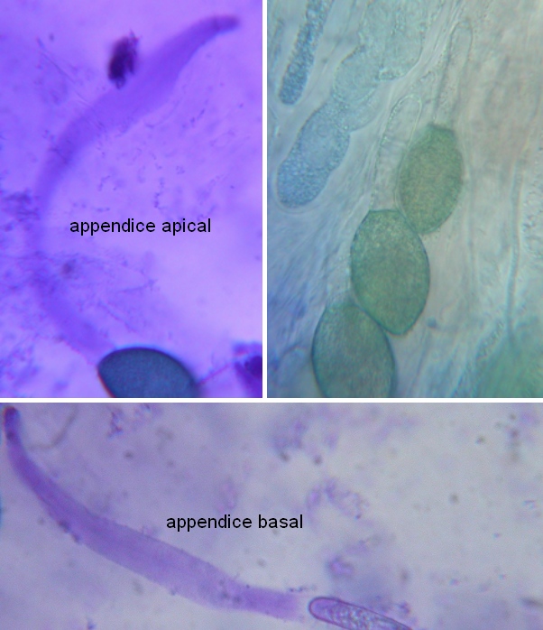 macrostoma