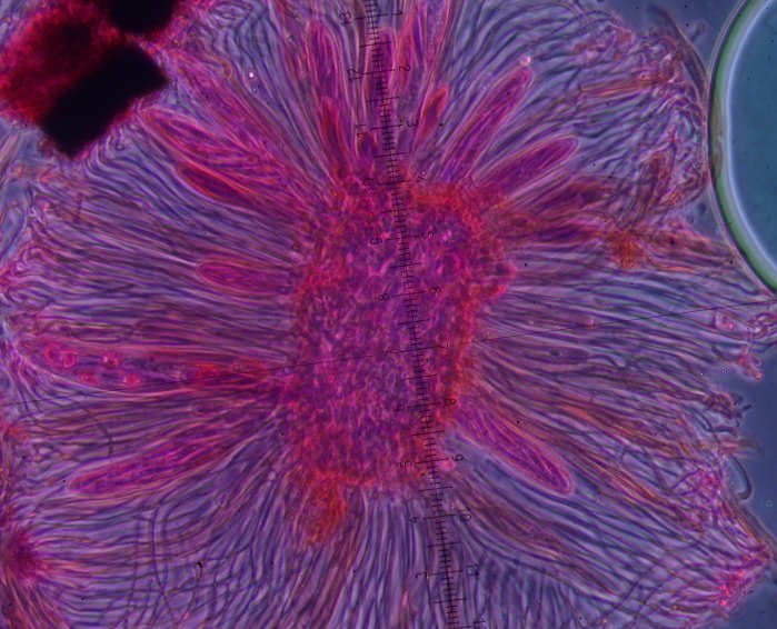 macrostoma