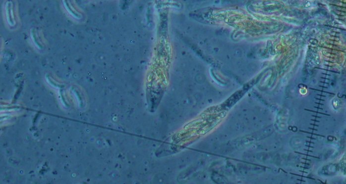 macrostoma
