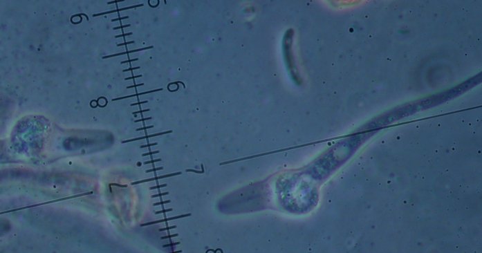 macrostoma