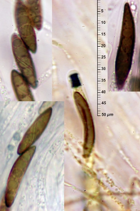 macrostoma
