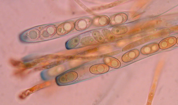 macrostoma