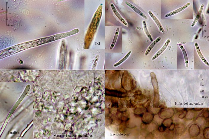 macrostoma