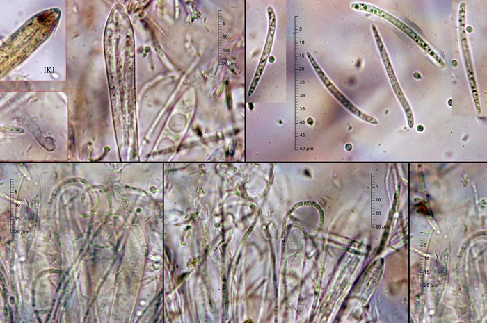 macrostoma