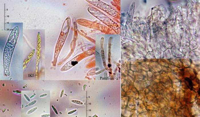 macrostoma