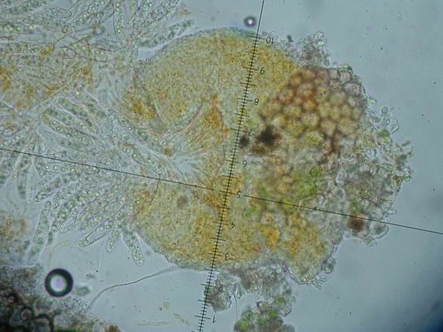 macrostoma