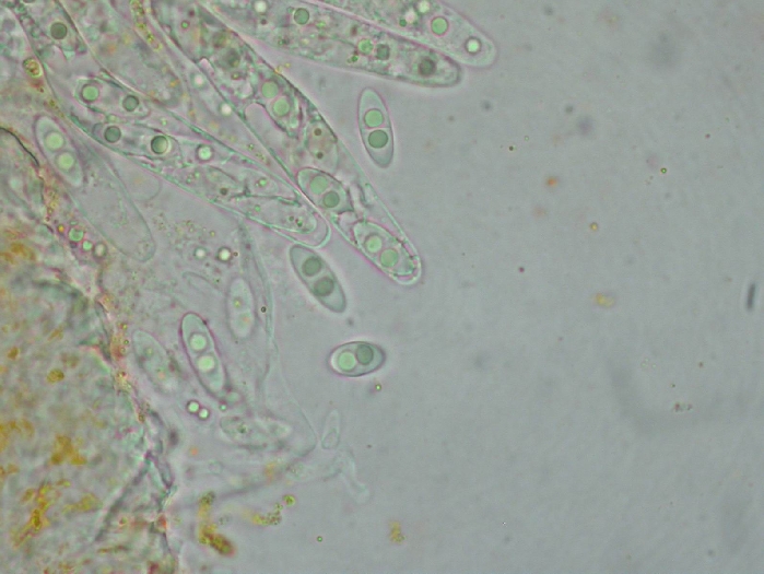 macrostoma