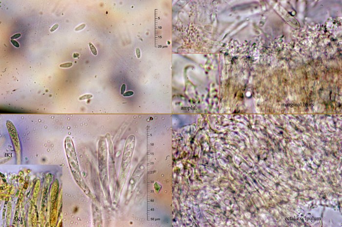 macrostoma