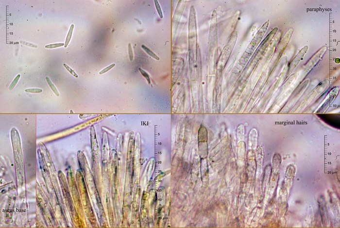 macrostoma