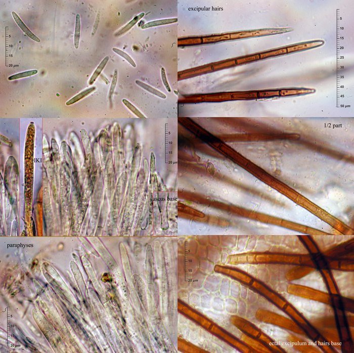 macrostoma
