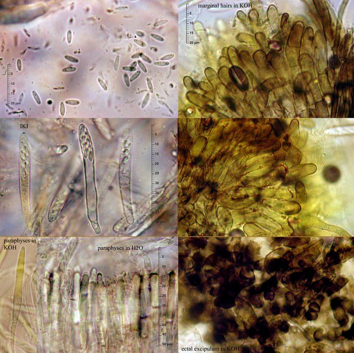 macrostoma
