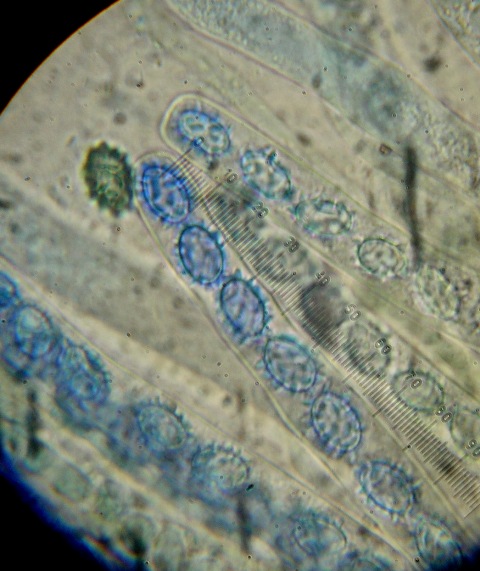 macrostoma