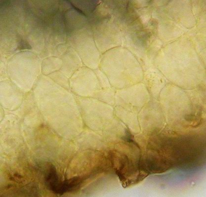 macrostoma