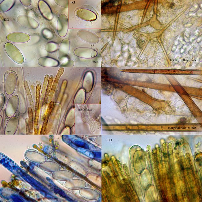 macrostoma