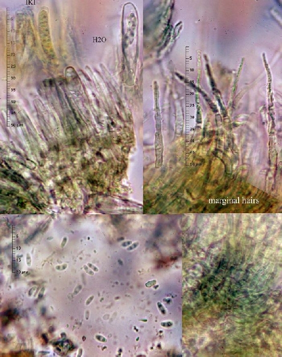 macrostoma