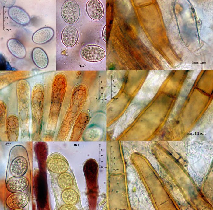 macrostoma
