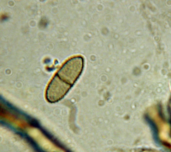 macrostoma