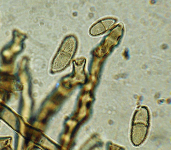 macrostoma