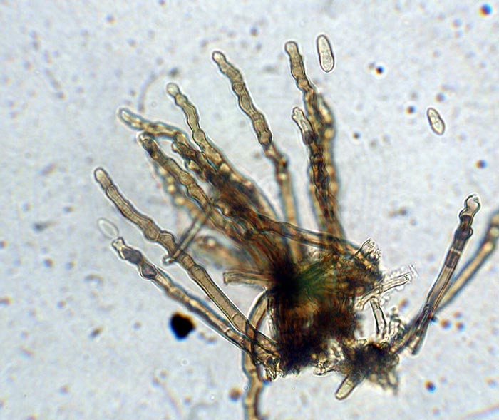 macrostoma