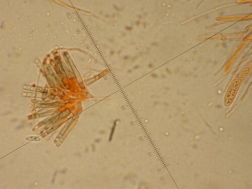 macrostoma