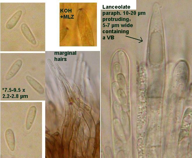 macrostoma