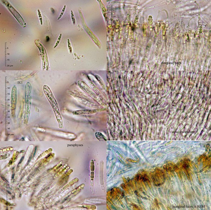 macrostoma