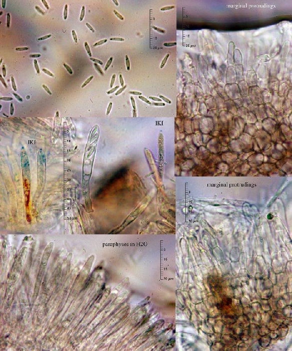 macrostoma