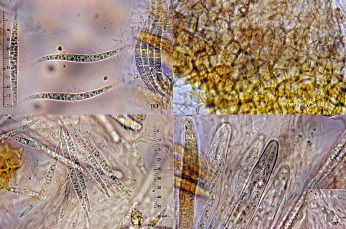 macrostoma
