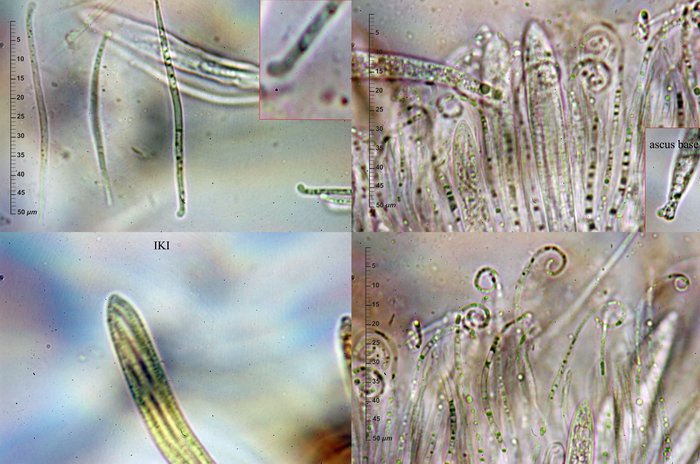 macrostoma
