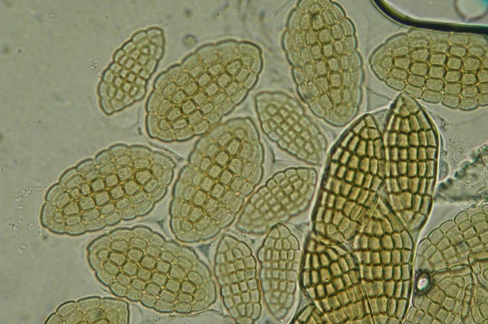 macrostoma
