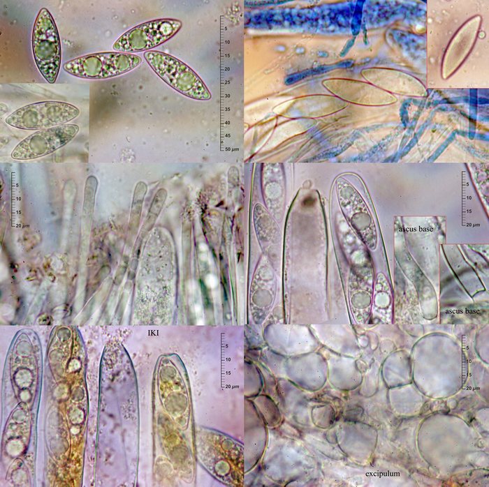 macrostoma