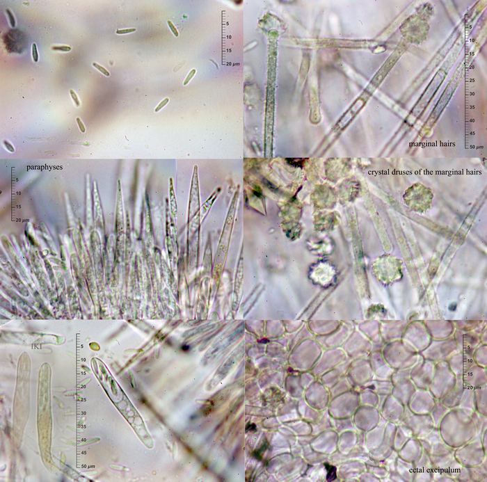 macrostoma