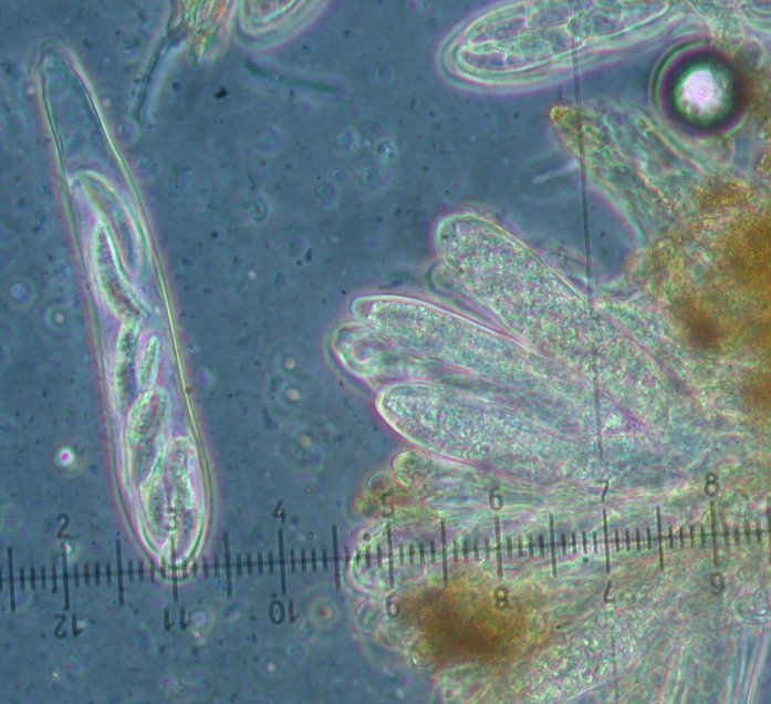 macrostoma