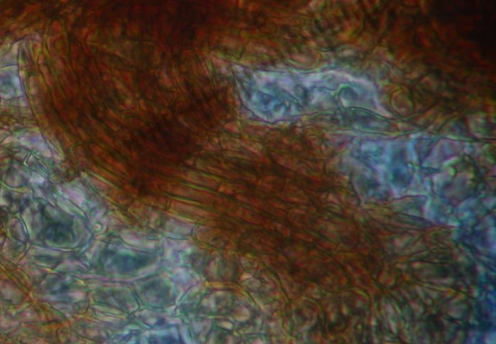 macrostoma