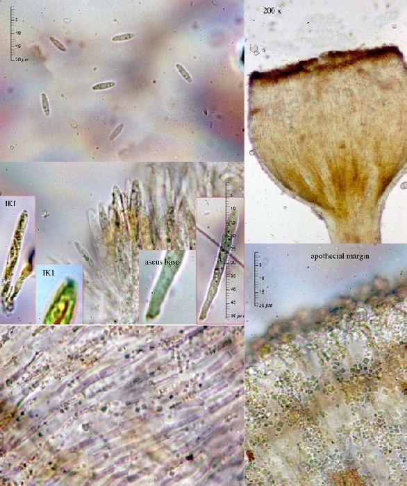 macrostoma